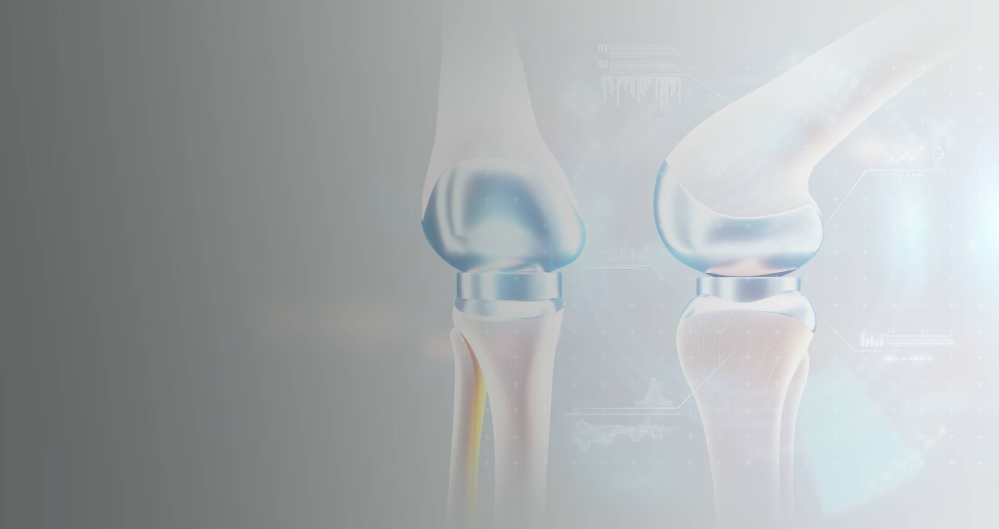 CIRUGÍA ORTOPÉDICA Y TRAUMATOLOGÍA